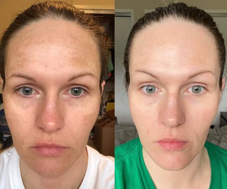 Brittany B. transformation