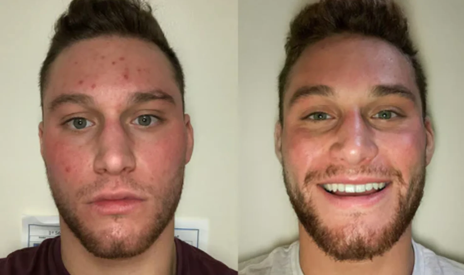 Marcus T. transformation